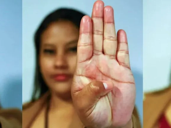 Governo de RO vai capacitar estabelecimentos públicos e privados para maior segurança e acolhimento das mulheres