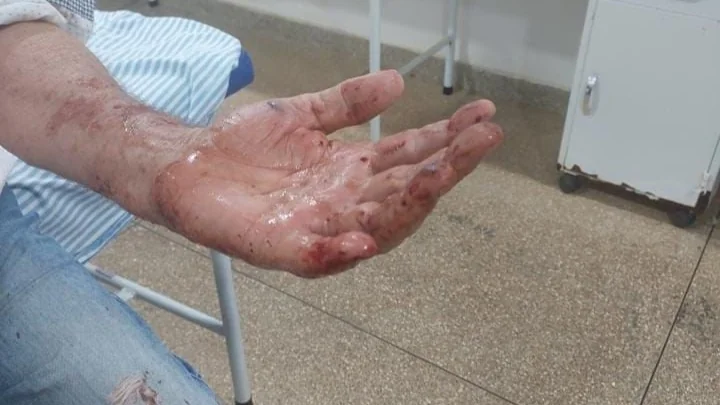 Homem é suspeito de tentar matar o próprio pai com facão e pauladas em Costa Marques